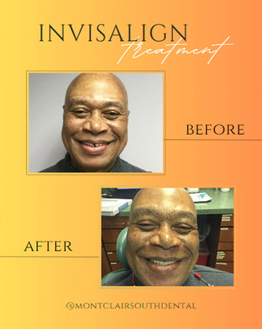 Montclair South Dental | Emergency Treatment, Orthodontics and VELscope reg  Cancer Screening